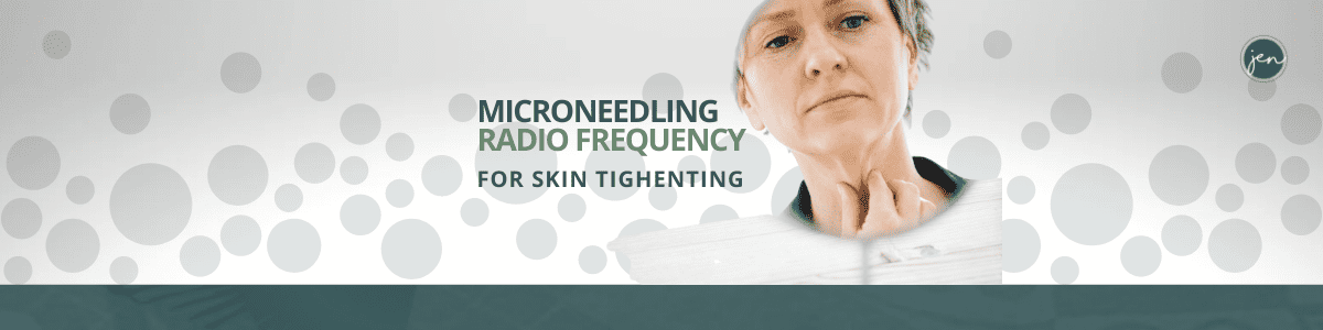 microneedling-radio-frequency-featured-image