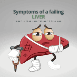 Symptoms of failing liver