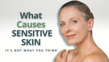 What Causes Sensitive Skin