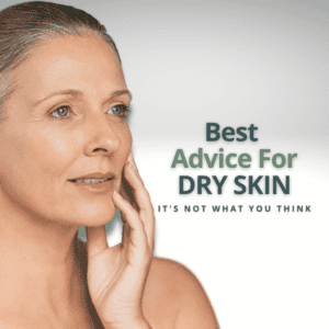 best-advice-dry-skin-1