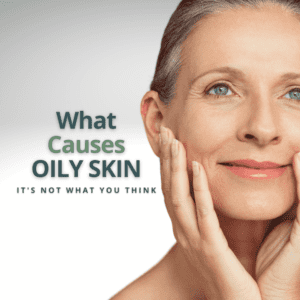 what-causes-oily-skin-1