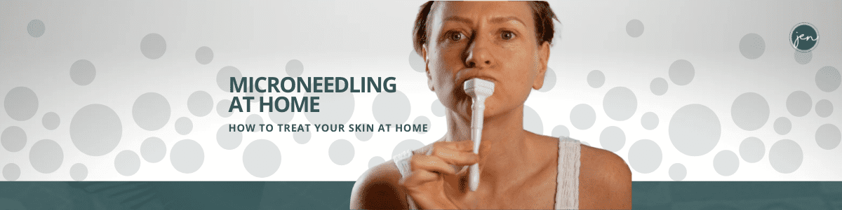 Microneedling at home