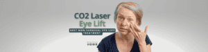 BEST Non-Surgical Eye Lift Treatment