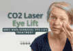 BEST Non-Surgical Eye Lift Treatment